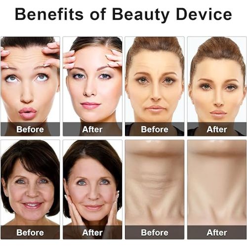 red blue light therapy facial wand Abu Dhabi for wrinkle reduction and skin rejuvenation